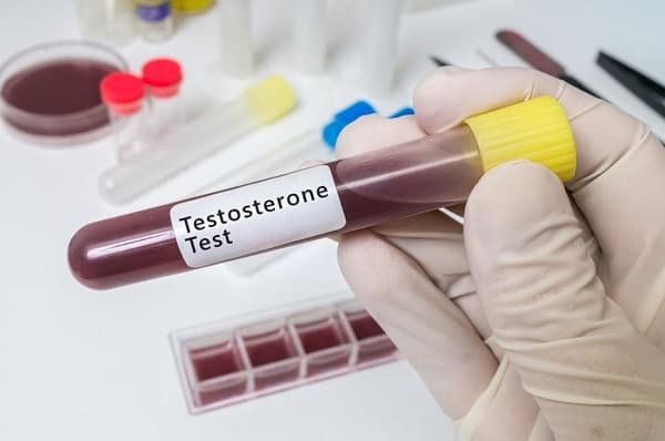 Testosteron teste